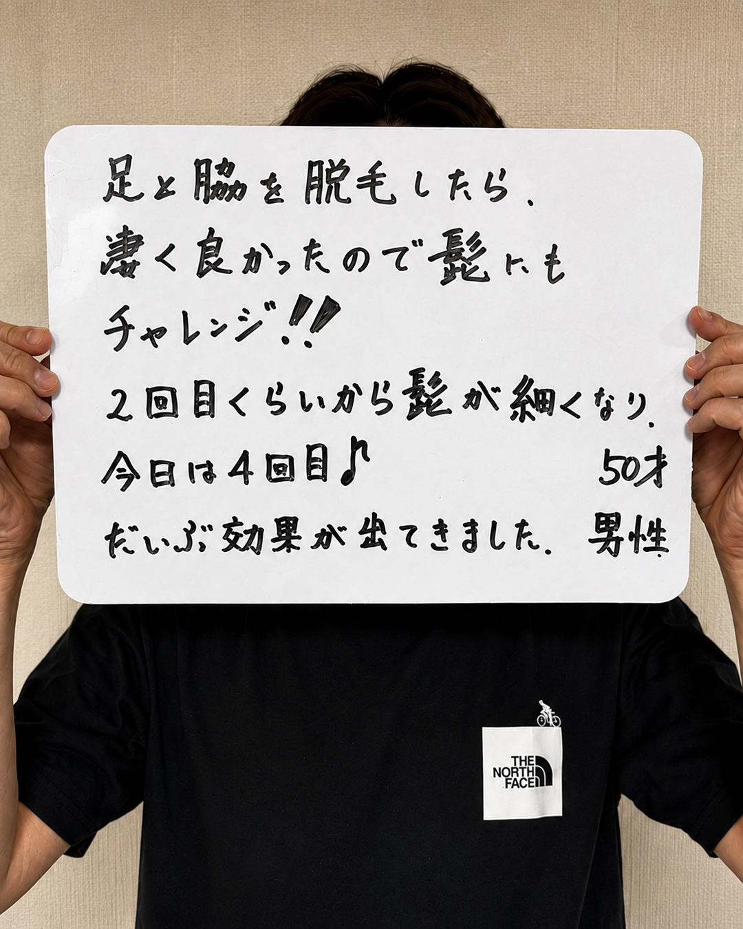 足・ワキ脱毛4回目の50歳男性のお客様の声。「2回目ぐらいから髪が細くなり、だいぶ効果が出てきました」と書かれた手書きの口コミ写真。